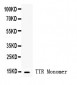 Anti-Prealbumin Picoband Antibody
